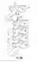Fig. 06 - PROSTHETIC WIDE RANGE MOTION FACETS AND METHODS OF FABRICATING SAME