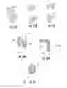 Fig. 11 - PROSTHETIC WIDE RANGE MOTION FACETS AND METHODS OF FABRICATING SAME