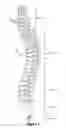 Fig. 02 - Method for resurfacing a cervical articular facet