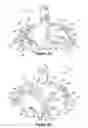 Fig. 03 - Method for resurfacing a cervical articular facet