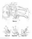 Fig. 05 - Method for resurfacing a cervical articular facet