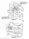 Fig. 06 - Method for resurfacing a cervical articular facet