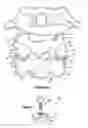 Fig. 07 - Method for resurfacing a cervical articular facet
