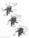 Fig. 03 - Method and composition for repair and reconstruction of intervertebral discs and other reconstructive surgery