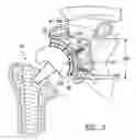 Fig. 05 - Method and apparatus for performing a shoulder implant procedure