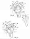 Fig. 07 - Method and apparatus for performing a shoulder implant procedure
