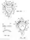Fig. 08 - Method and apparatus for performing a shoulder implant procedure