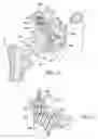 Fig. 10 - Method and apparatus for performing a shoulder implant procedure