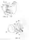 Fig. 13 - Method and apparatus for performing a shoulder implant procedure