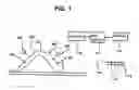 Fig. 02 - Functional joint arthroplasty method