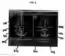 Fig. 09 - Functional joint arthroplasty method