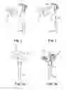 Fig. 02 - Tibial component with a conversion module for a knee implant