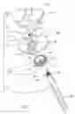 Fig. 02 - Offset stem tibial implant