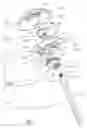 Fig. 03 - Offset stem tibial implant
