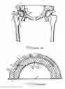 Fig. 02 - Acetabular cup assembly and cup revising method