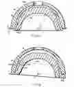 Fig. 04 - Acetabular cup assembly and cup revising method