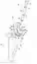 Fig. 01 - Hip stem centralizer cap and method