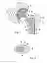 Fig. 02 - Hip stem centralizer cap and method