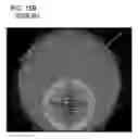 Fig. 20 - Double side wafer grinder and methods for assessing workpiece nanotopology