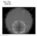 Fig. 20 - Double side wafer grinder and methods for assessing workpiece nanotopology