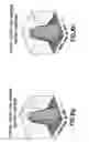 Fig. 13 - Volume based extended defect sizing system