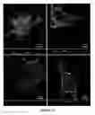 Fig. 10 - Method of promoting delivery of an antioxidant agent to a cell expression neuroligin