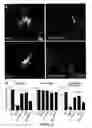 Fig. 16 - Method of promoting delivery of an antioxidant agent to a cell expression neuroligin