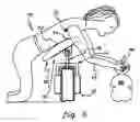 Fig. 07 - Bathing aid