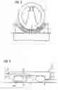 Fig. 03 - Device for installing a cylindrical gradient coil in a cylindrical magnet of a magnetic resonance system