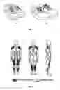 Fig. 02 - Rear balance walking shoes