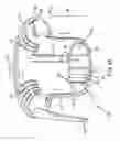 Fig. 05 - Air cleaner airflow shaper