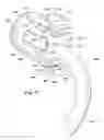Fig. 07 - Ventilator to tracheotomy tube coupling