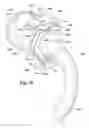 Fig. 08 - Ventilator to tracheotomy tube coupling