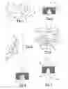 Fig. 02 - Mouth guard