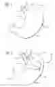 Fig. 02 - Method and devices for modifying the function of a body organ