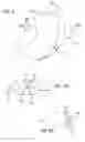 Fig. 07 - Method and devices for modifying the function of a body organ