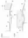 Fig. 06 - Needle and manufacturing method thereof