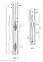 Fig. 02 - Self-anchoring device with force amplification
