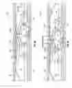 Fig. 08 - Self-anchoring device with force amplification