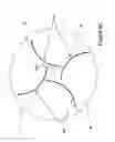 Fig. 08 - Field director assembly having overheating protection