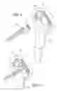 Fig. 09 - Apparatus for performing trans-anal resection