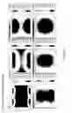 Fig. 30 - Digital image capture and processing engine employing optical waveguide technology for collecting and guiding LED-based illumination during object illumination and image capture modes of operation