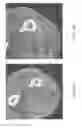 Fig. 07 - Variable resolution x-ray CT detector with target imaging capability