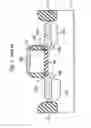 Fig. 02 - Semiconductor device and its manufacturing method capable of suppressing junction leakage current
