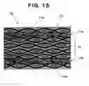 Fig. 15 - RTM molding method and device
