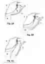 Fig. 03 - Method for storing a side curtain air bag