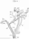 Fig. 10 - Vehicle front end structure