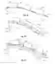 Fig. 07 - Magnetic transmission