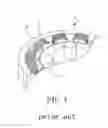 Fig. 02 - Motor stator device
