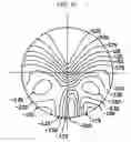Fig. 48 - Bi-aspherical type progressive-power lens and method of designing the same